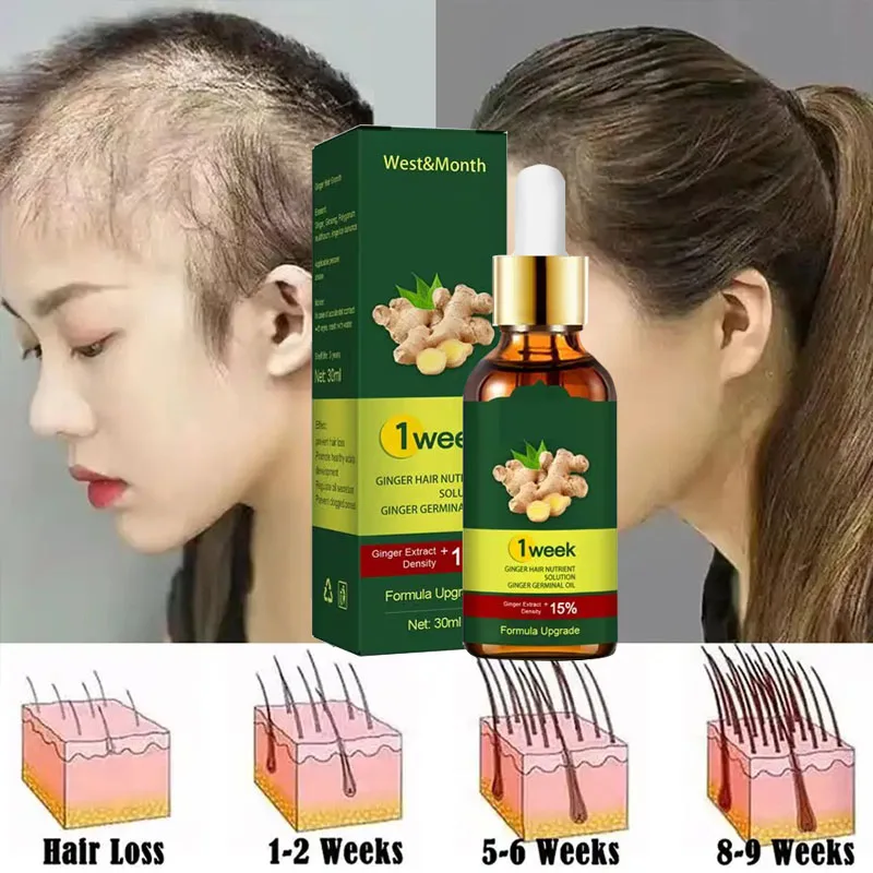 Licorice Root Sticks - 洗髪用エッセンシャルオイル,髪の成長製品,髪の強化,頭皮治療,にきびケア,7日