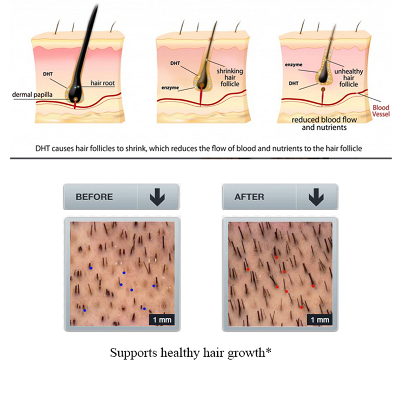 Purc-Tanh脱毛シャンプー,育毛治療,根修復,ヘアケア - Licorice Root Sticks のレビューと価格